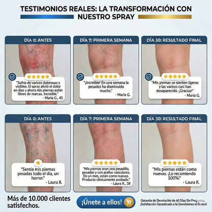 Spray para Varices Crioterapia Pro™