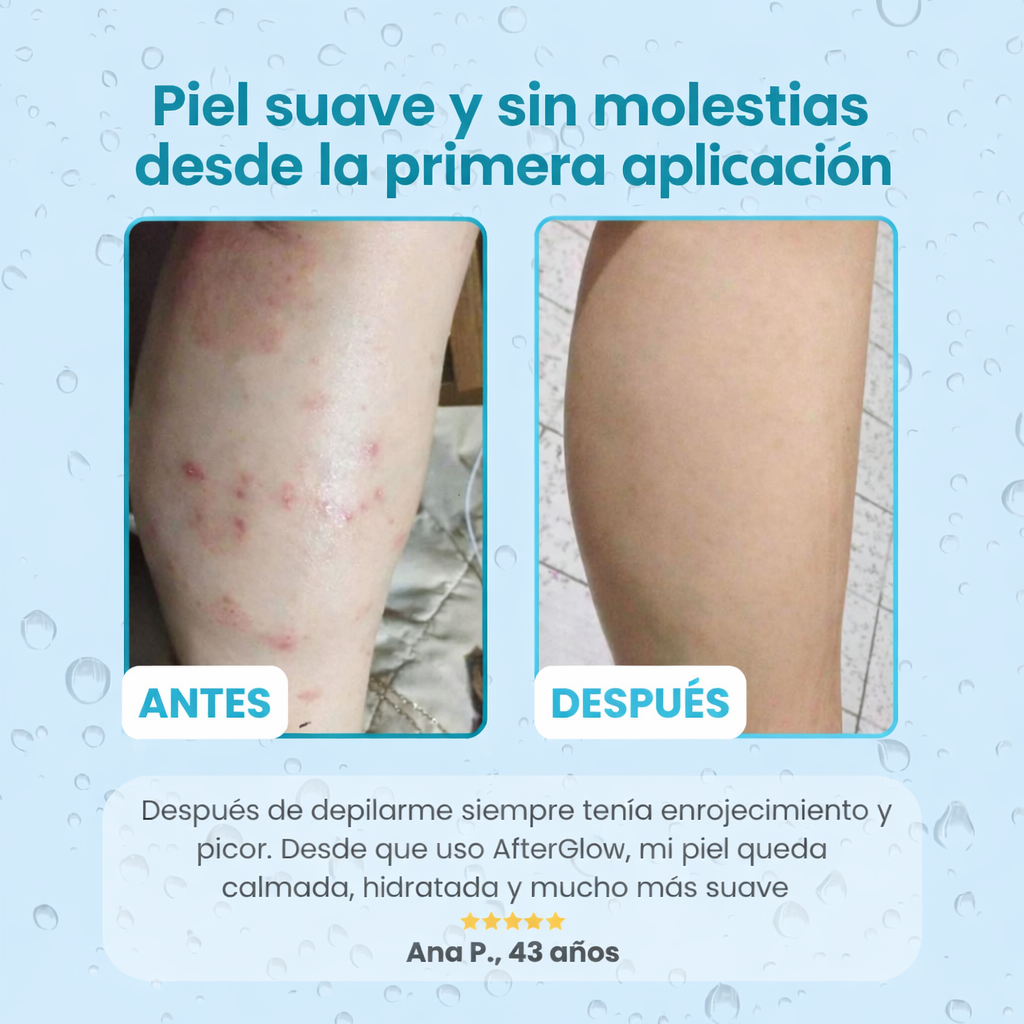 AfterGlow™ | DILE ADIÓS A LA PIEL DE FRESA, IRRITACIÓN Y PELOS ENQUISTADOS AL INSTANTE