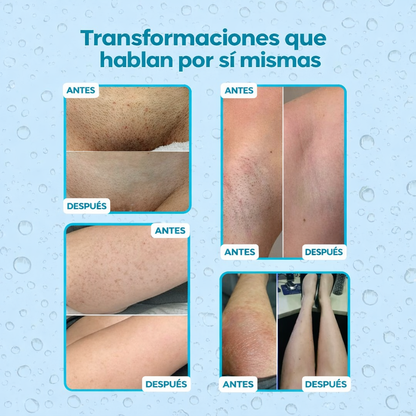 AfterGlow™ | DILE ADIÓS A LA PIEL DE FRESA, IRRITACIÓN Y PELOS ENQUISTADOS AL INSTANTE