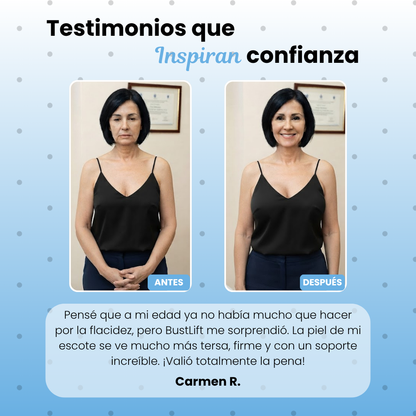 BustLift® El secreto botánico para un busto más firme y tonificado