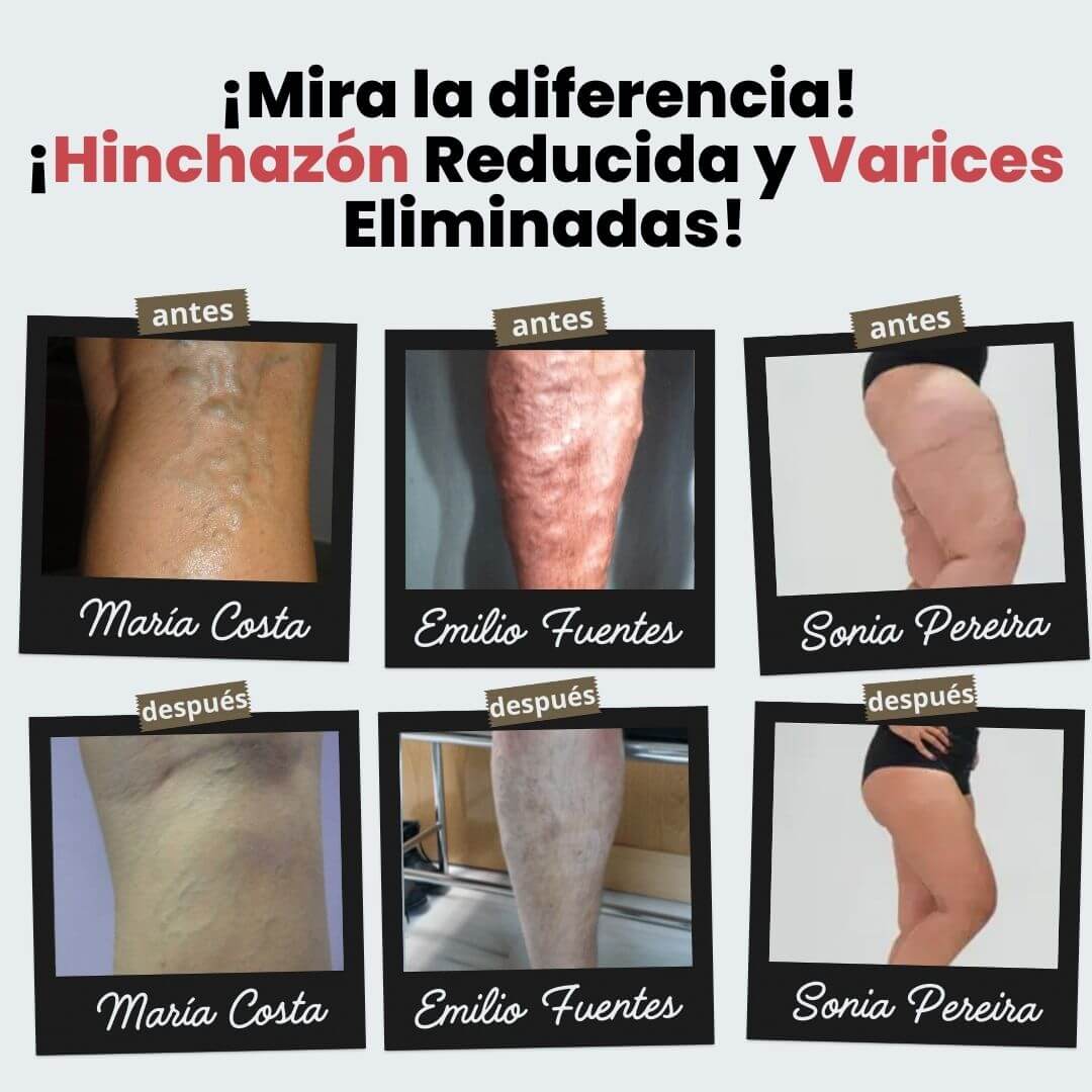 Calcetines  Anti-Varices Beautibra™